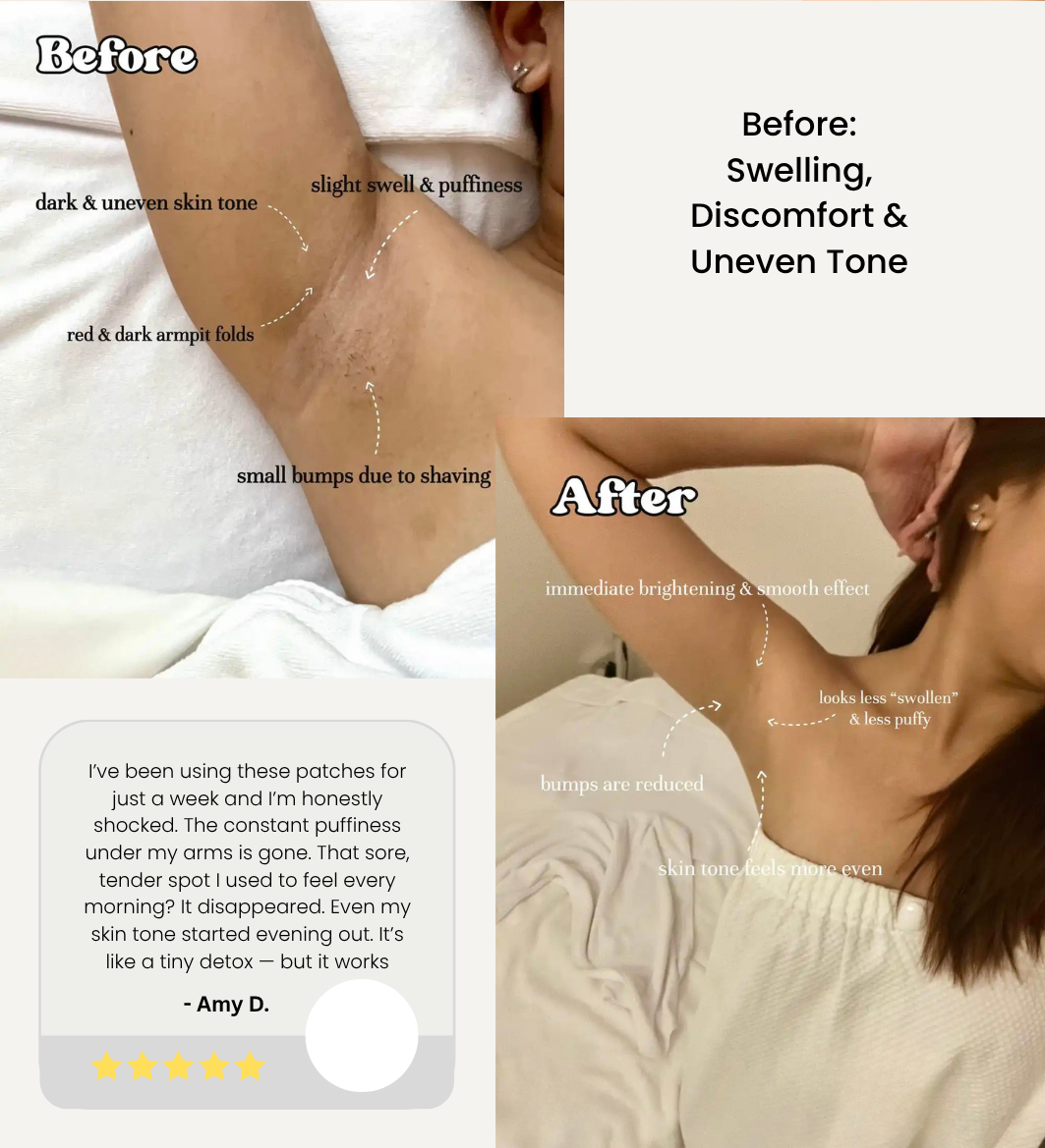 Lymphology – The #1 Patches for Reducing Armpit & Chin Puffiness