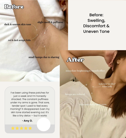 Lymphology – The #1 Patches for Reducing Armpit & Chin Puffiness