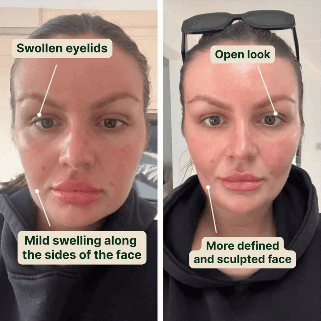 Lymphatic Drainage Drops
