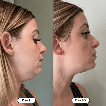 Lymphology – The #1 Patches for Reducing Armpit & Chin Puffiness