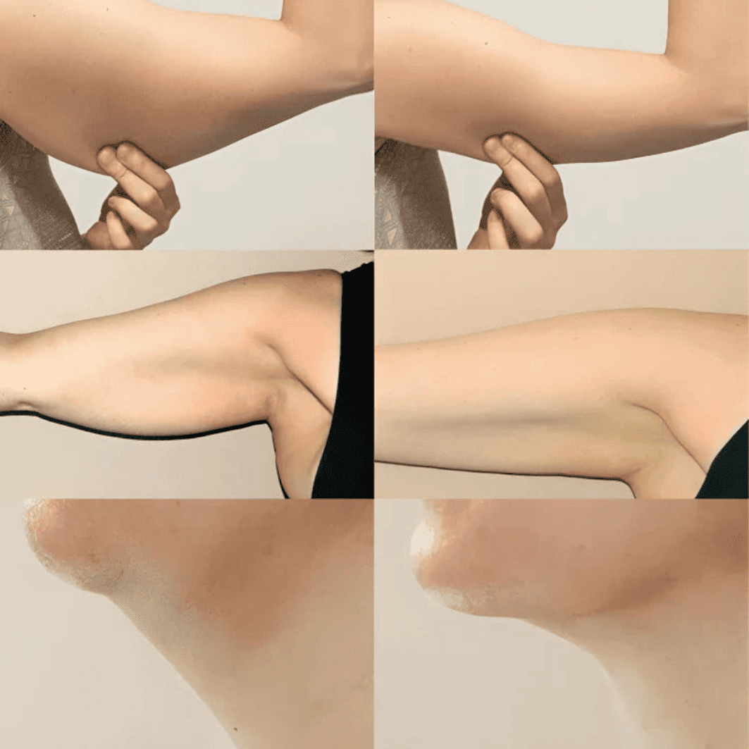 Lymphatic Drainage Drops